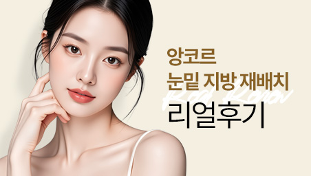 앙코르눈밑지방재배치