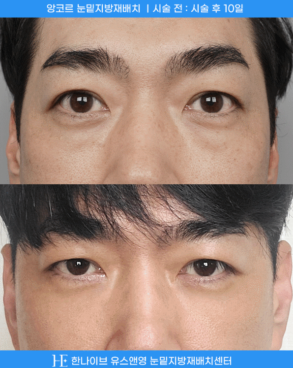 uploaded_6a8545e2bf794.gif