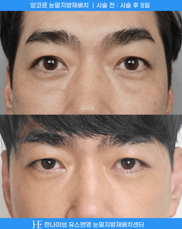 uploaded_6a8545eb17fa3.gif