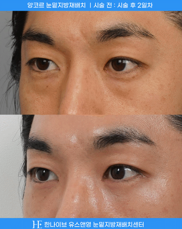 uploaded_6a8545ebaf6c9.gif