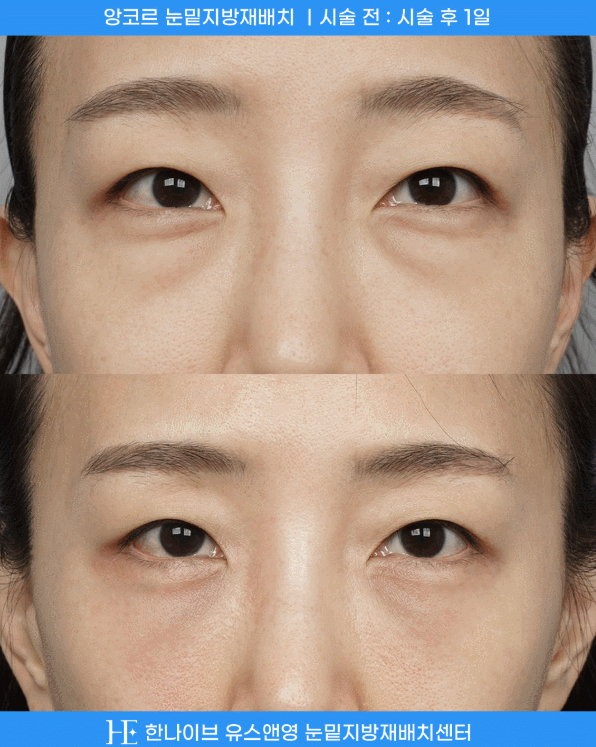 uploaded_6a8545fd18165.gif