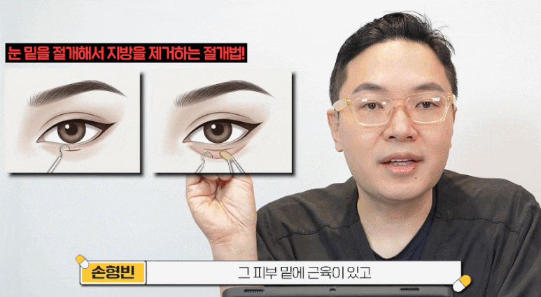 uploaded_6a865fc7e4693.gif