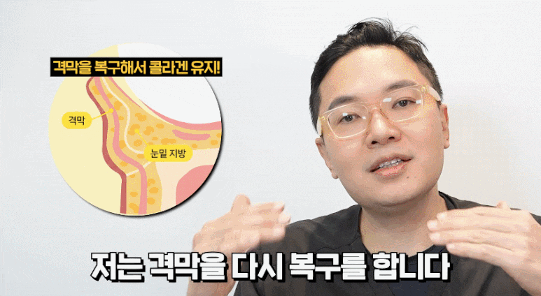 uploaded_6a865fcb326db.gif