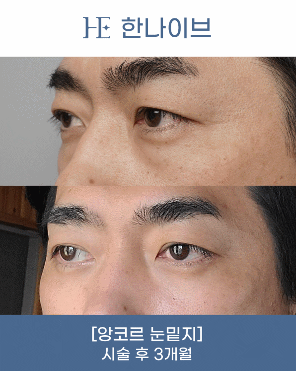 uploaded_6a865fcd3d8cc.gif