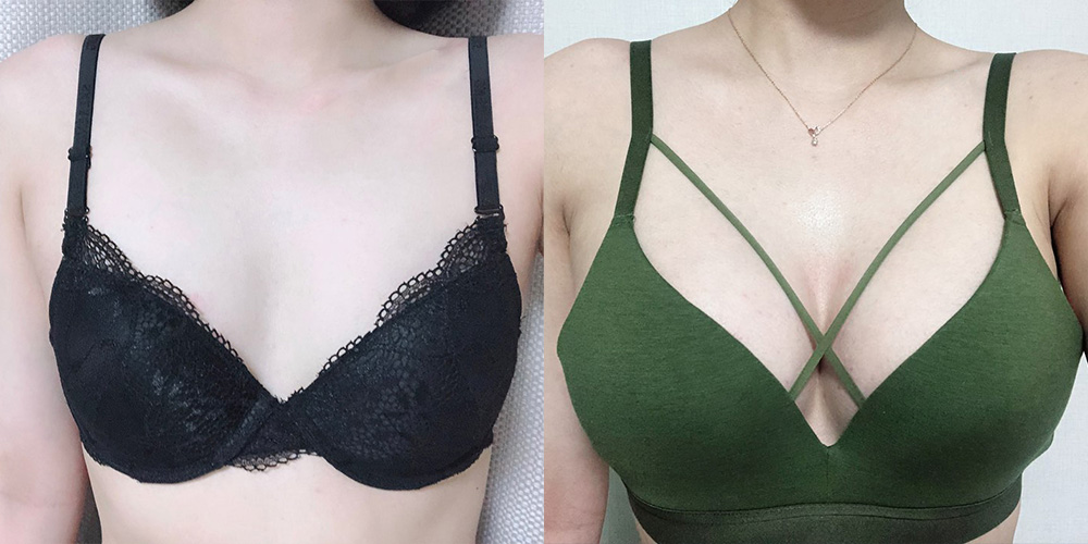 가슴확대(모티바)