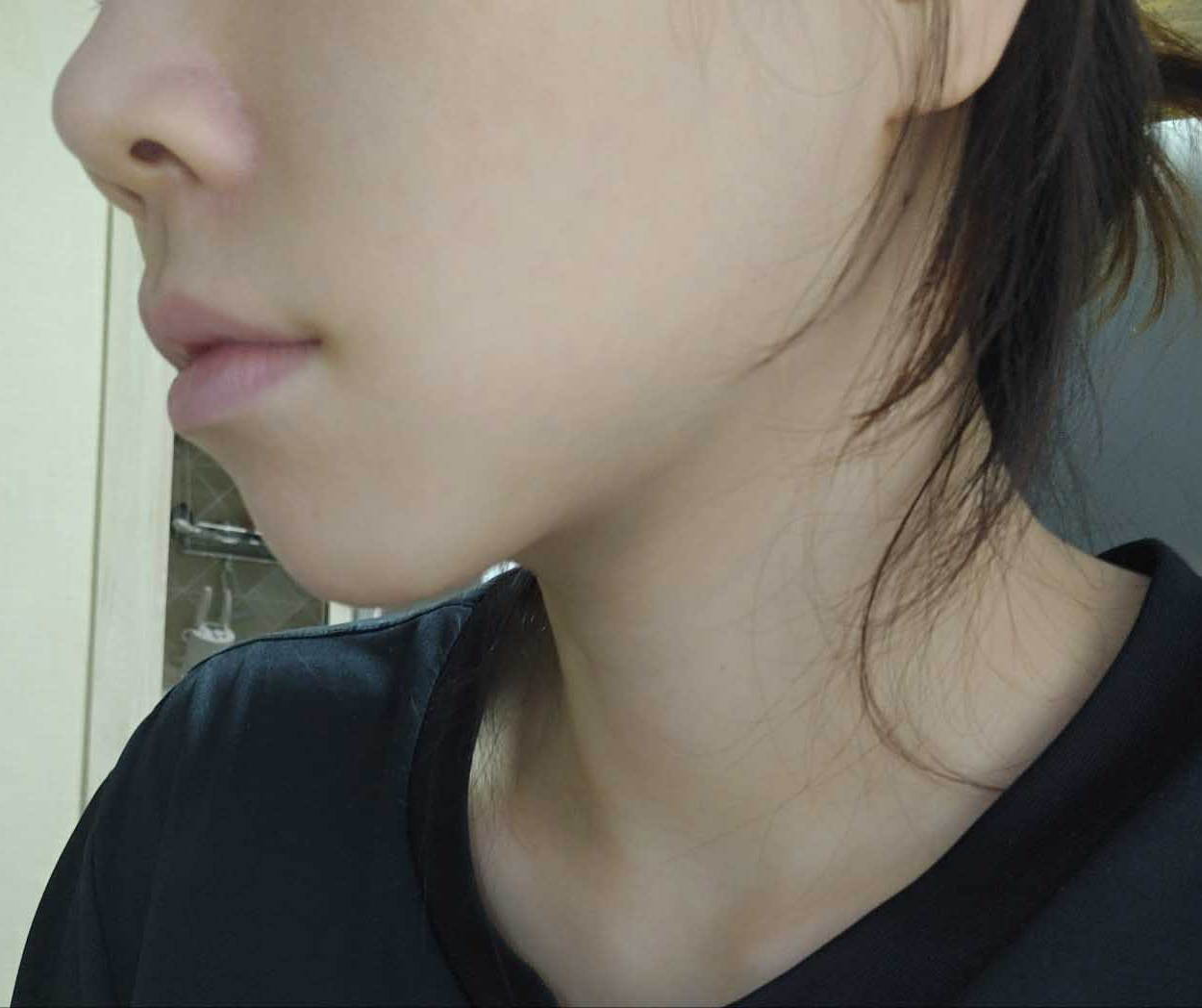 정면 후