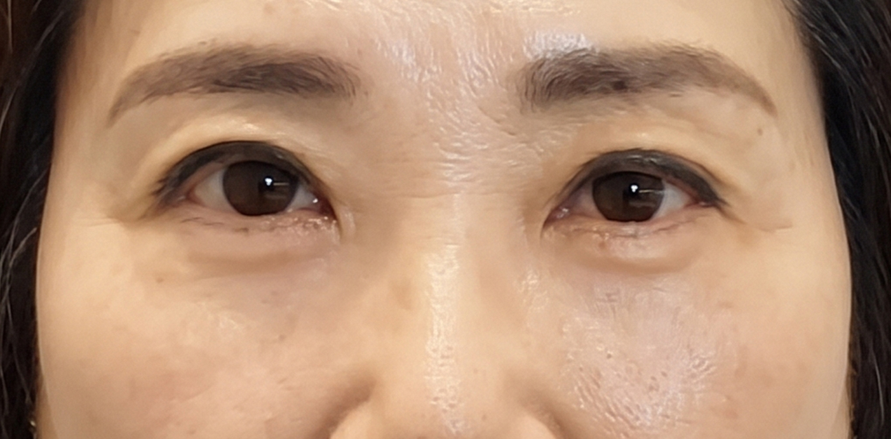 정면 후