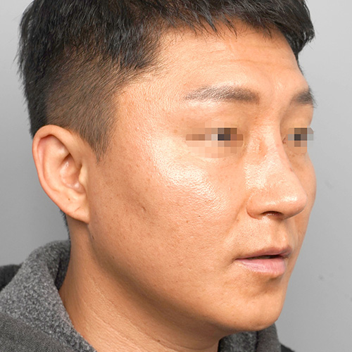정면 후