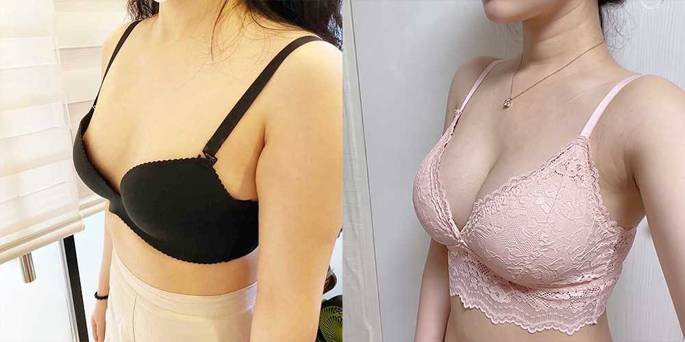가슴확대(모티바)