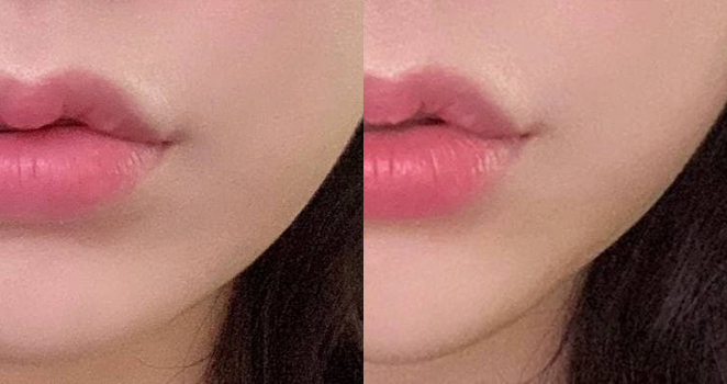 턱필러