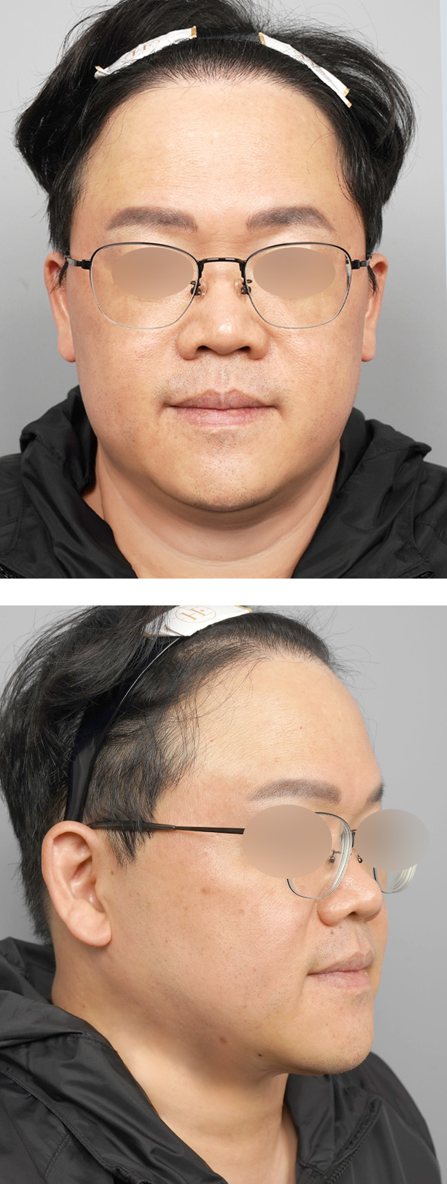 정면 후