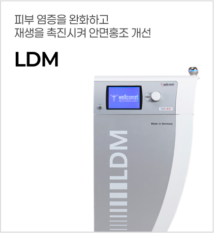 LDM