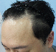 수술전