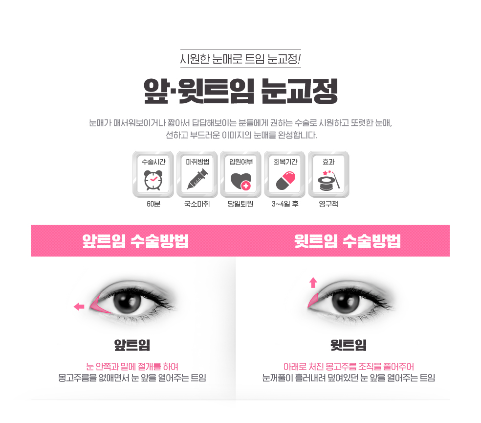 앞트임,윗트임