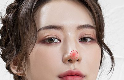 염증이생긴경우