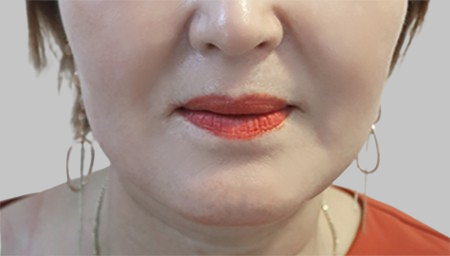 미니거상 2주 후