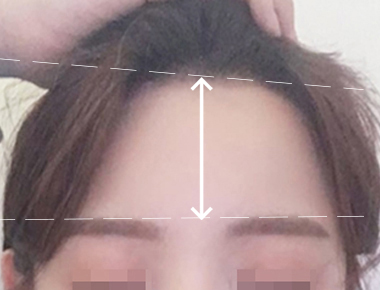 2개월 후