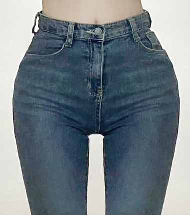 골반 필러 시술 후