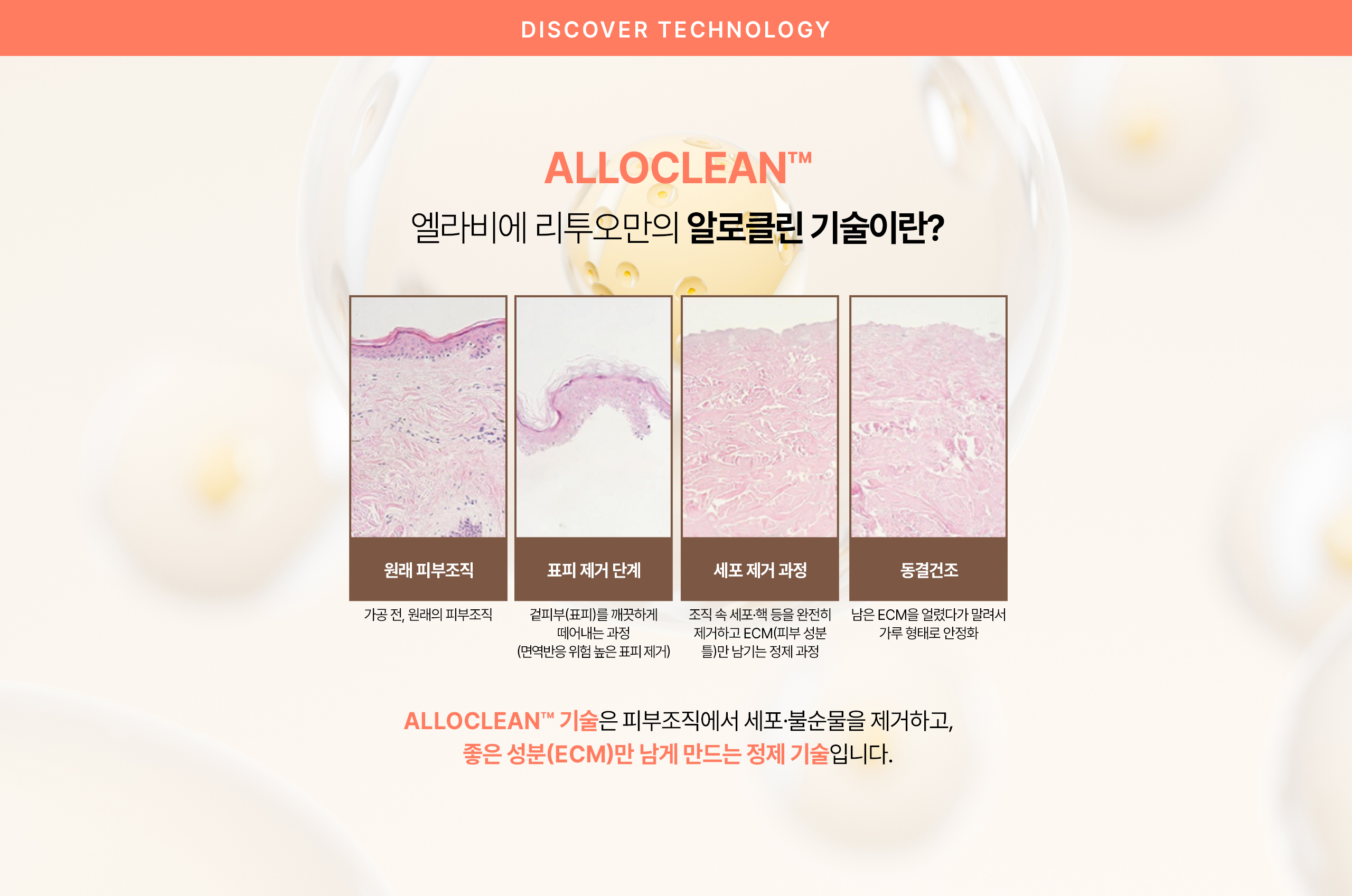 알로클린기술이란?