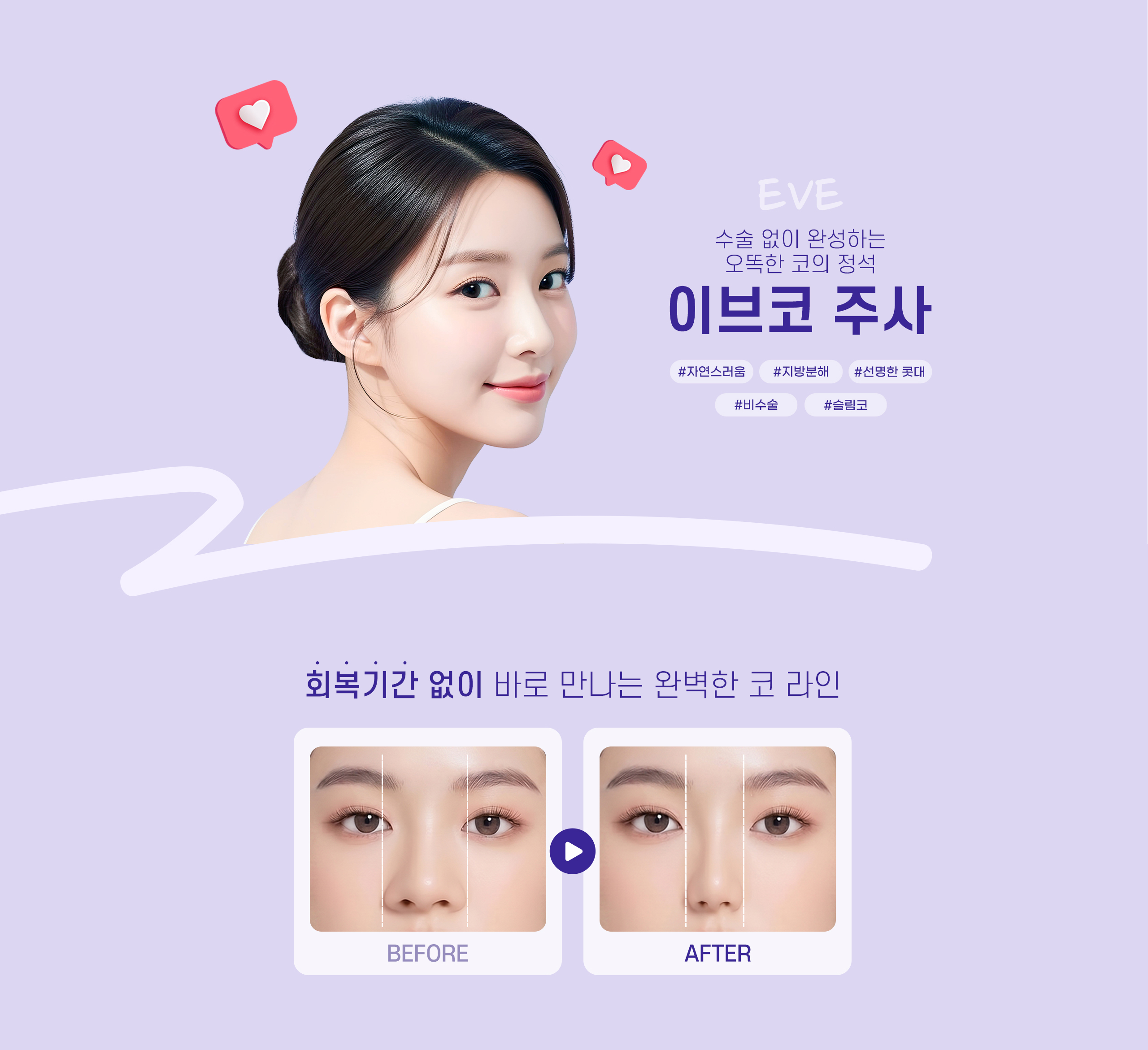 한나이브 이브코 주사