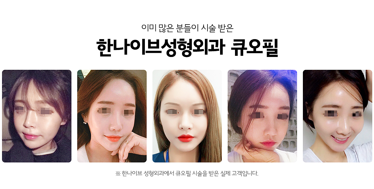 큐오필리얼후기