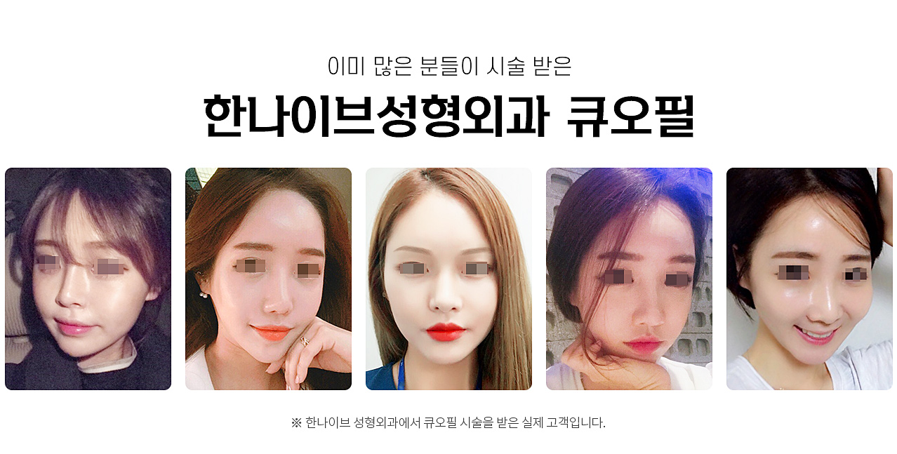 큐오필리얼후기