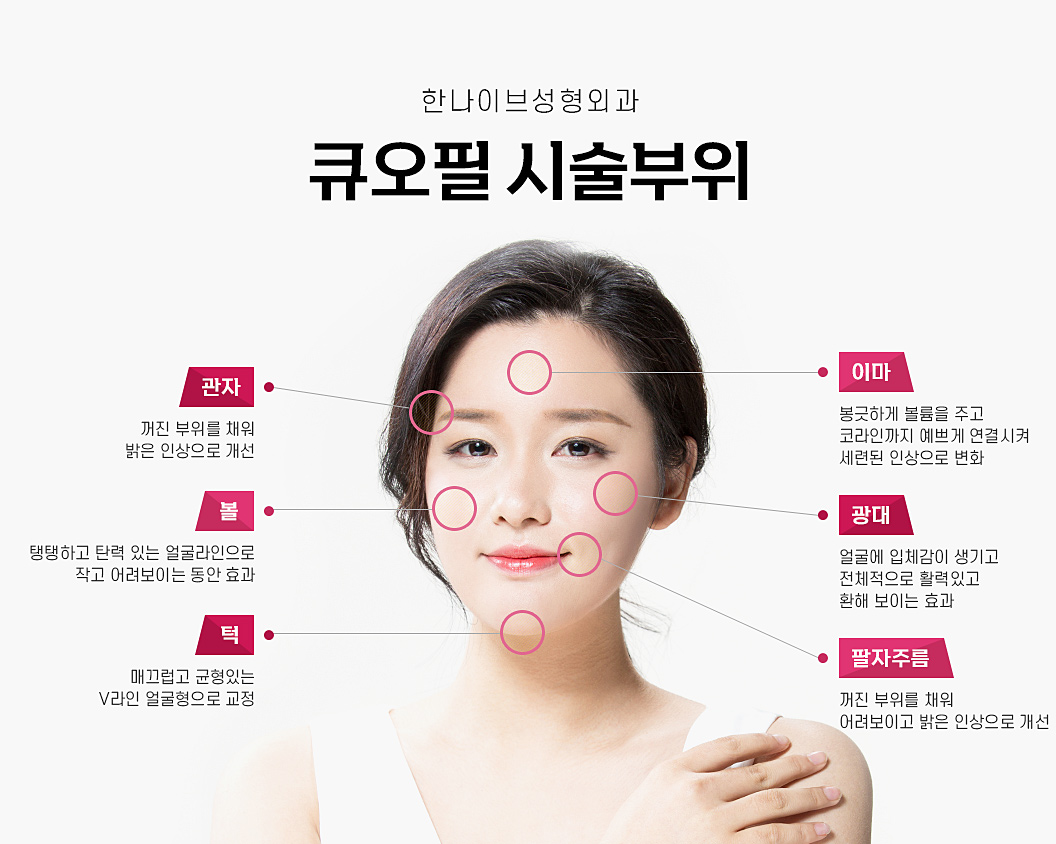 큐오필시술부위