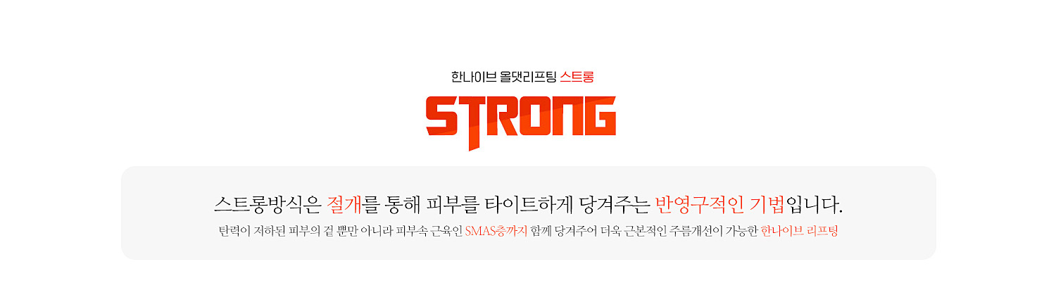 스트롱방식이란?