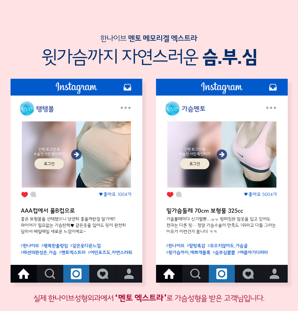 한나이브가슴성형