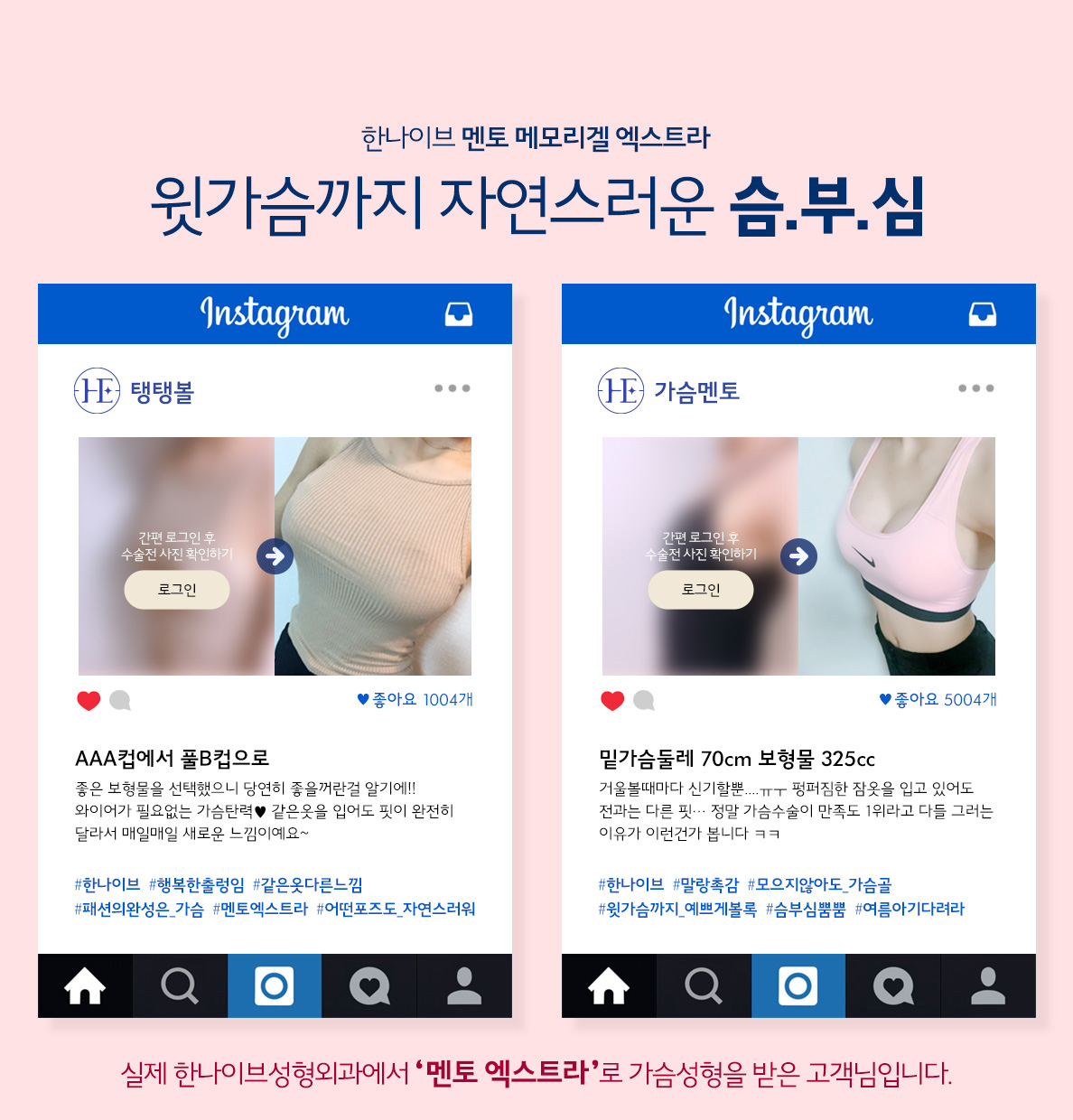 한나이브가슴성형