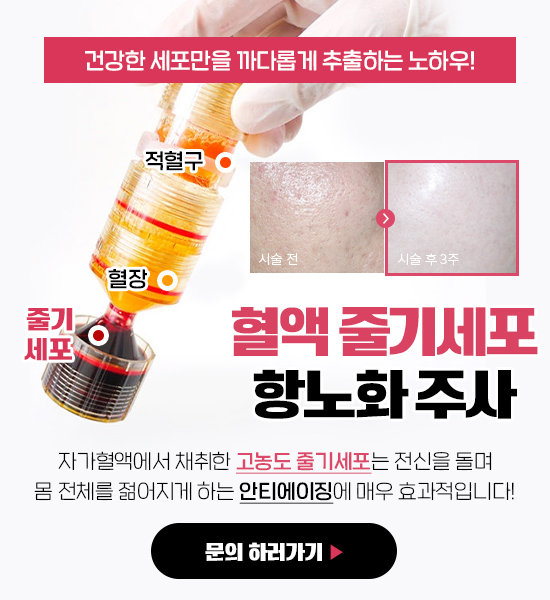 항노화주사문의하기