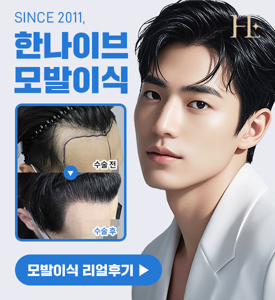 모발이식 리얼후기