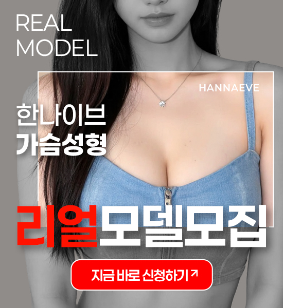 가슴성형 리얼모델모집