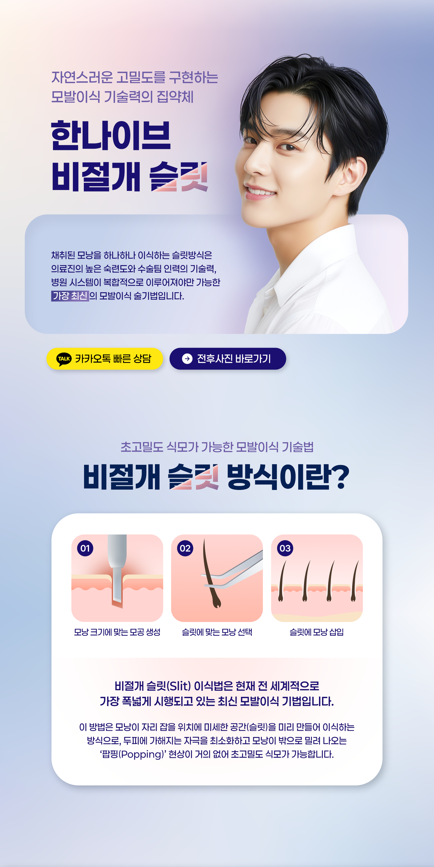 비절개슬릿모발이식