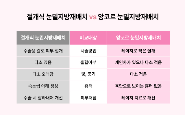 앙코르 눈밑지방재배치 비교