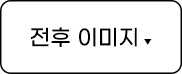 앙코르눈밑지 전후 이미지