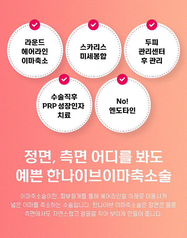 이마축소술이란?