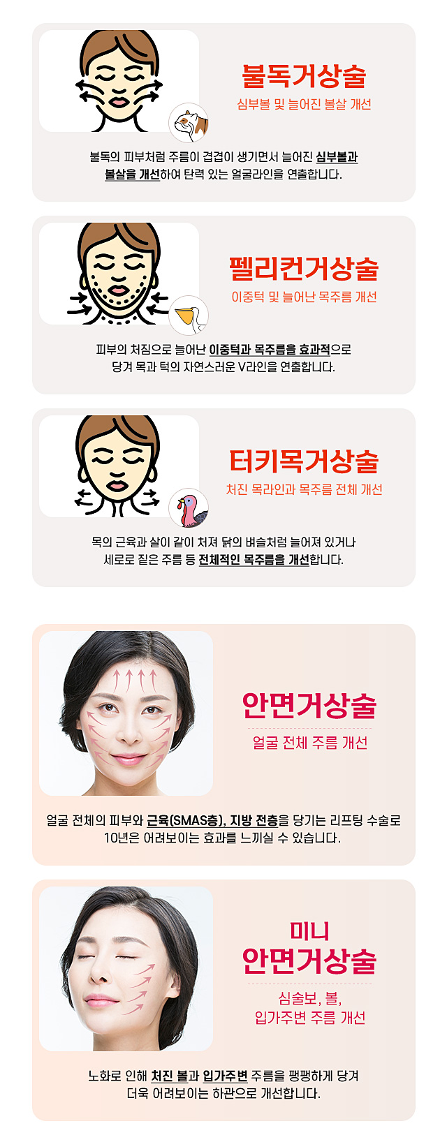 스트롱방식종류