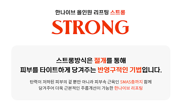 스트롱방식이란?