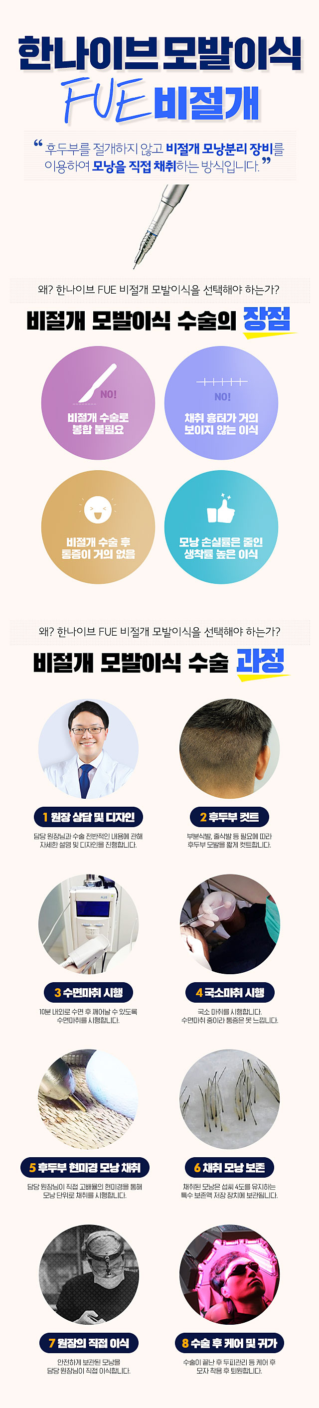 한나이브비절개모발이식