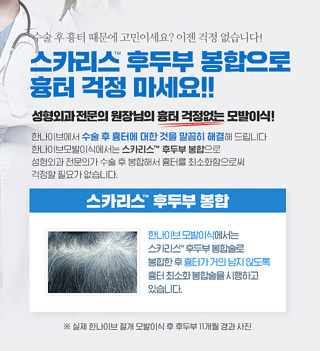 한나이브모발이식스카리스후두부봉합