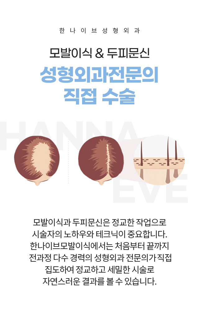 한나이브두피문신,성형외과전문의직접시술
