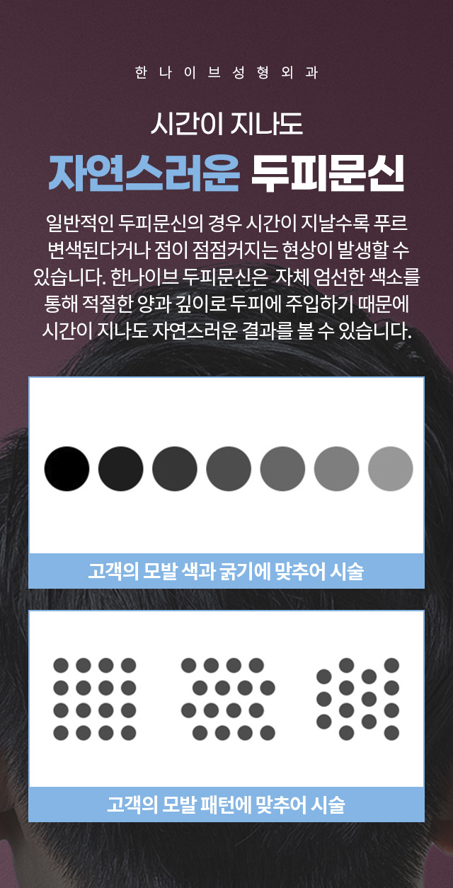 한나이브두피문신,시간이지나도자연스러움