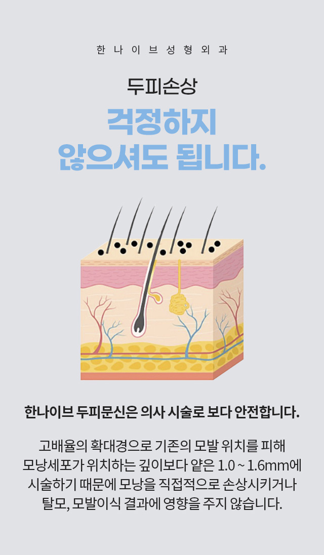 한나이브두피문신,두피손상걱정no