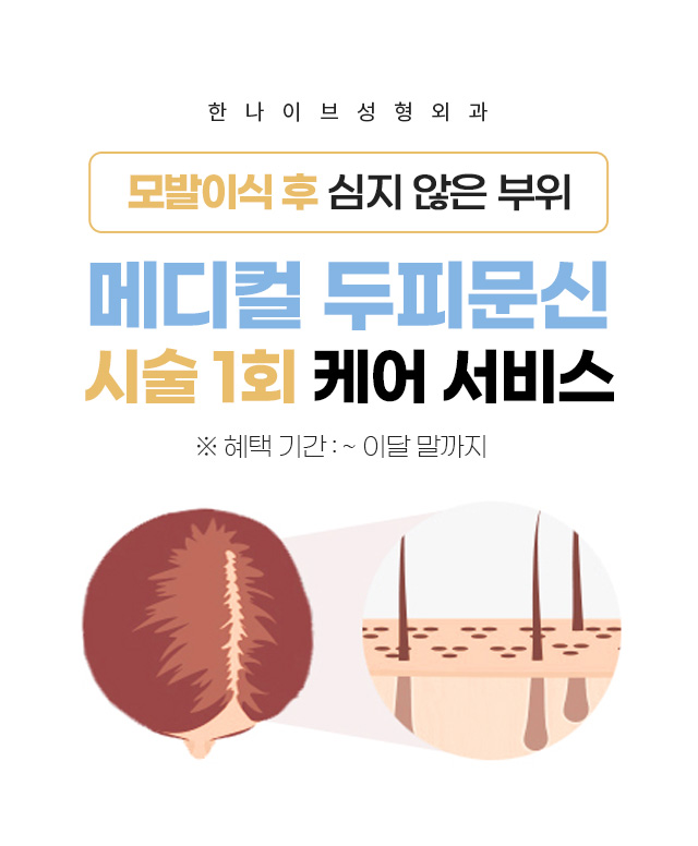 한나이브두피문신,1회서비스케어