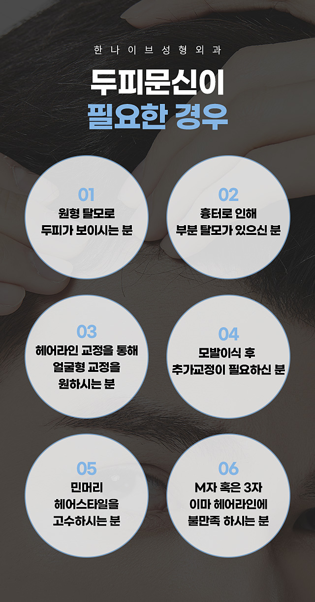 한나이브두피문신,필요한경우