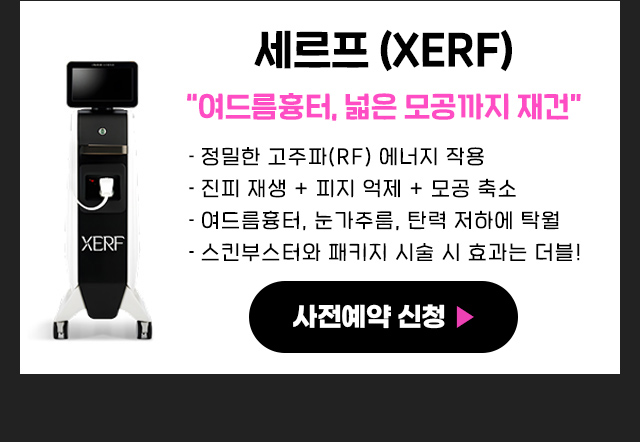 세르프특징