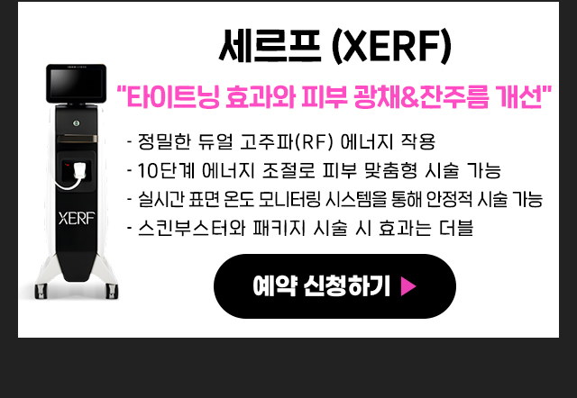 세르프특징