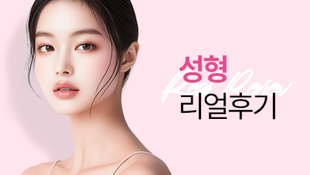 성형