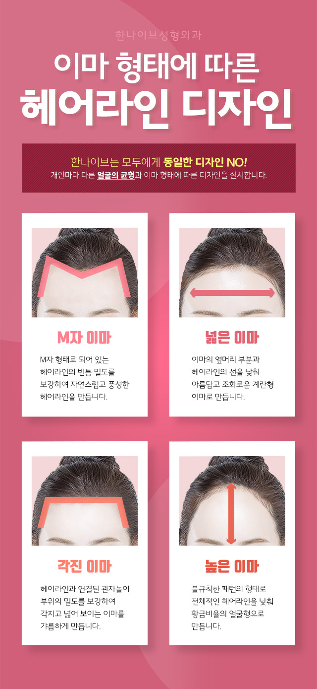 이마형태에따른디자인